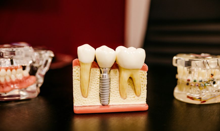 What is SEO and Why Does It Matter for Dentists?